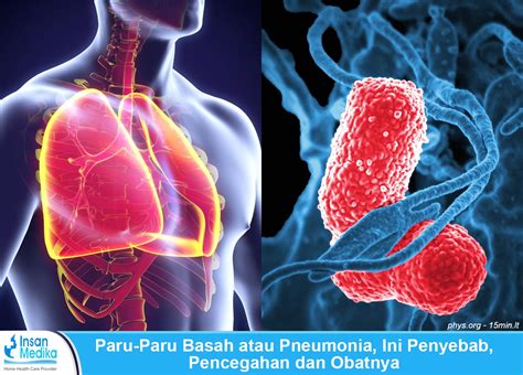 pneumonia adalah penyakit menular